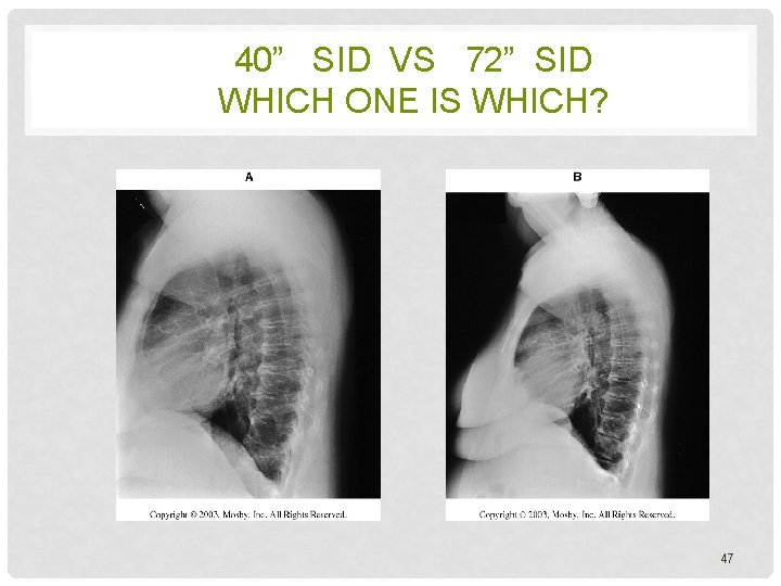 40” SID VS 72” SID WHICH ONE IS WHICH? 47 