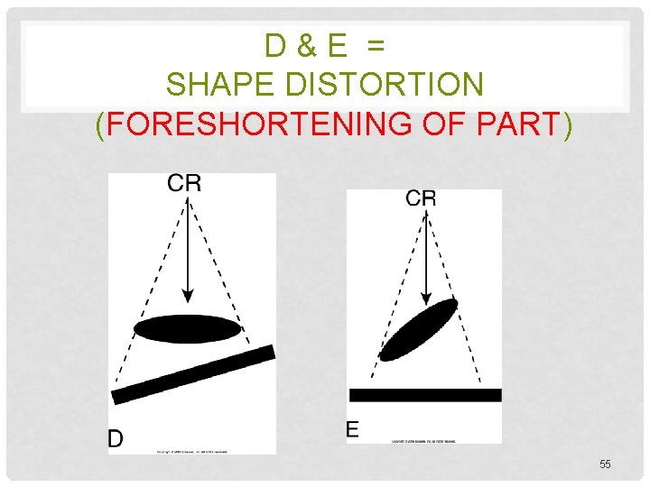 D & E = SHAPE DISTORTION (FORESHORTENING OF PART) 55 