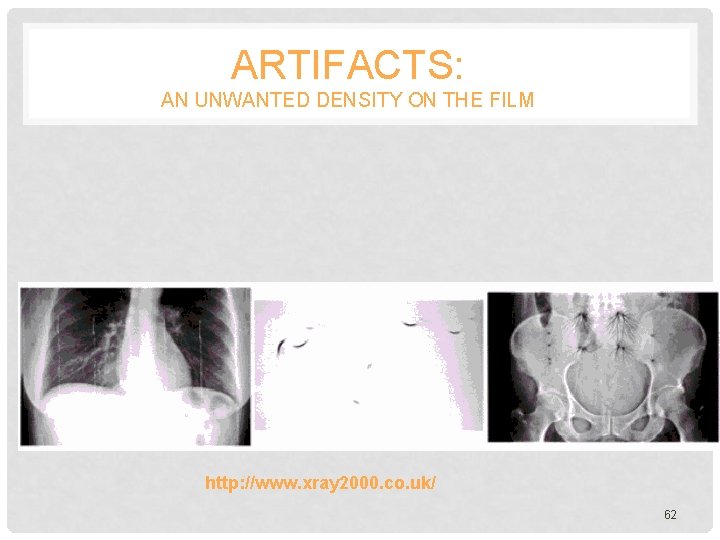 ARTIFACTS: AN UNWANTED DENSITY ON THE FILM http: //www. xray 2000. co. uk/ 62