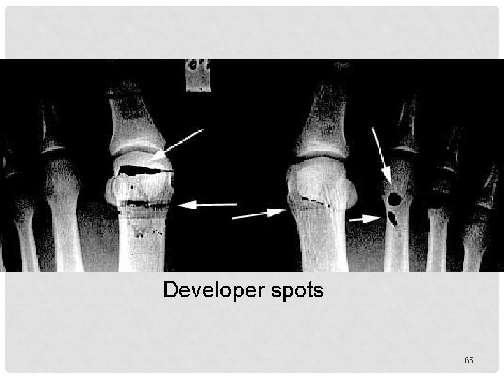 Developer spots 65 