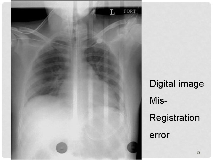 Digital image Mis. Registration error 93 