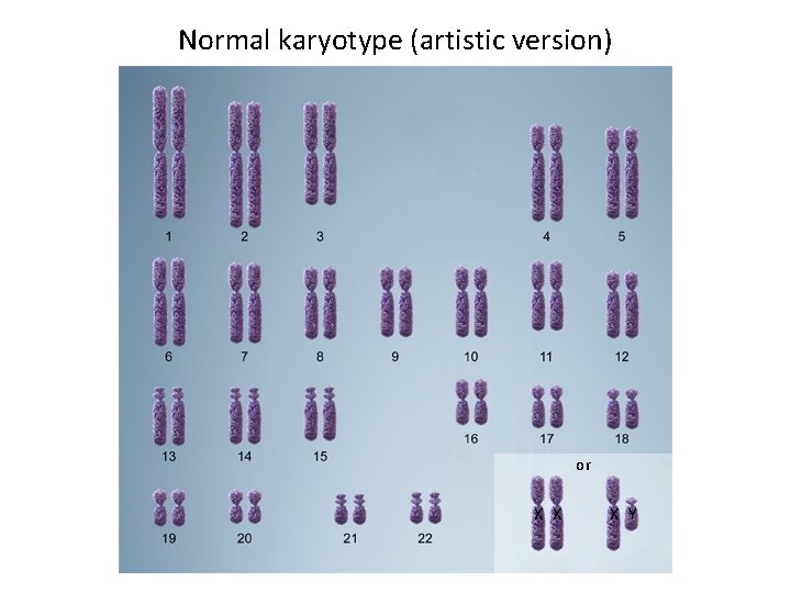 Normal karyotype (artistic version) or X X X Y 