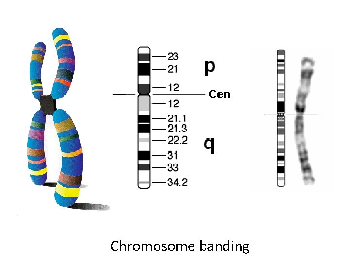 Chromosome banding 