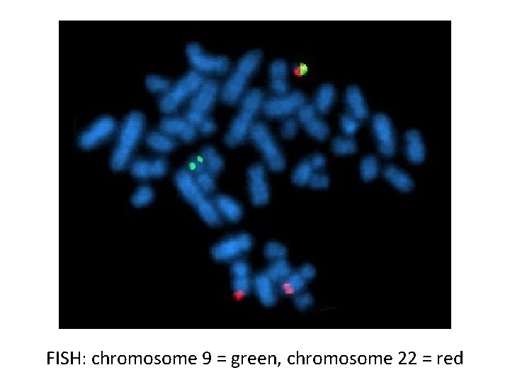 FISH: chromosome 9 = green, chromosome 22 = red 
