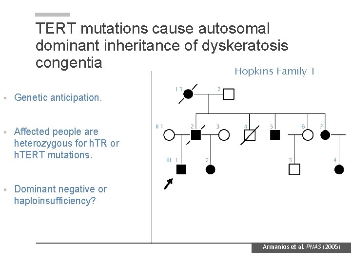 TERT mutations cause autosomal dominant inheritance of dyskeratosis congentia Hopkins Family 1 § Genetic TERT mutations cause autosomal dominant inheritance of dyskeratosis congentia Hopkins Family 1 § Genetic