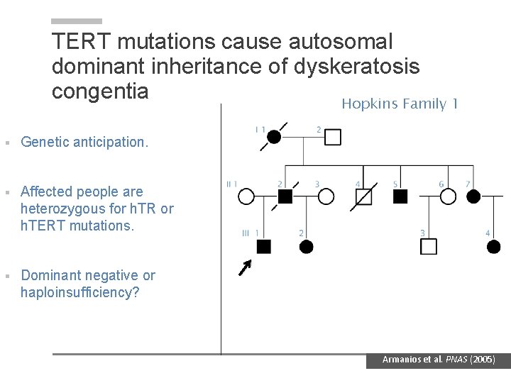 TERT mutations cause autosomal dominant inheritance of dyskeratosis congentia Hopkins Family 1 § Genetic