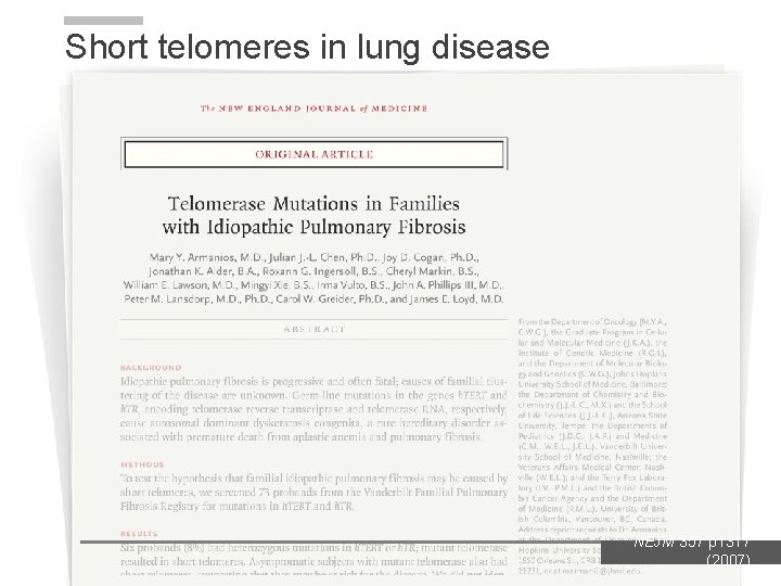 Short telomeres in lung disease NEJM 357 p 1317 (2007) Short telomeres in lung disease NEJM 357 p 1317 (2007)