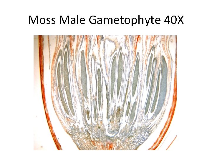 Moss Male Gametophyte 40 X 