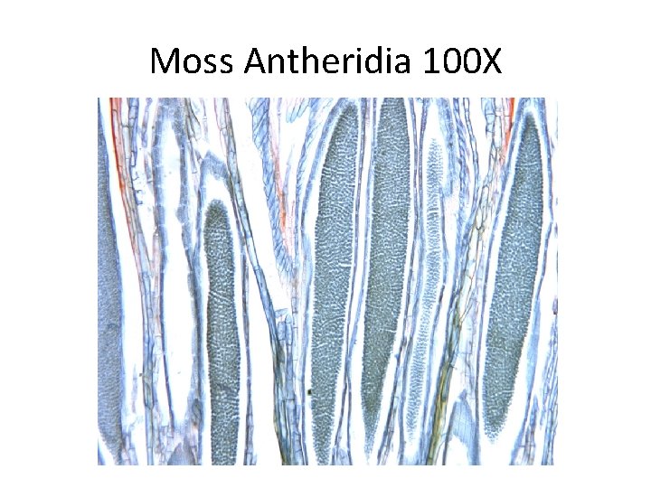 Moss Antheridia 100 X 