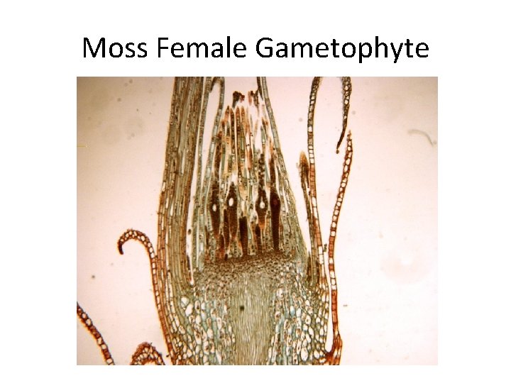 Moss Female Gametophyte 
