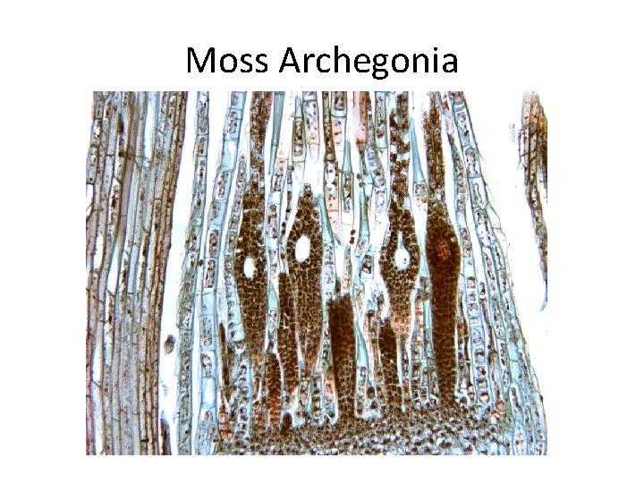Moss Archegonia 