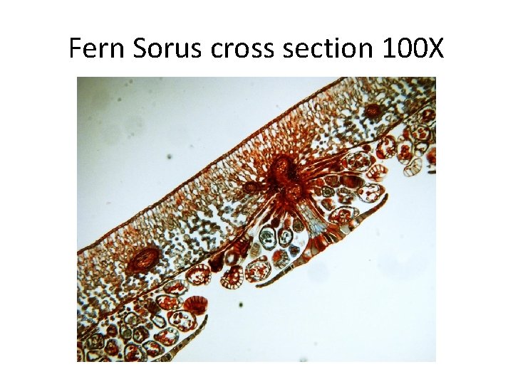 Fern Sorus cross section 100 X 