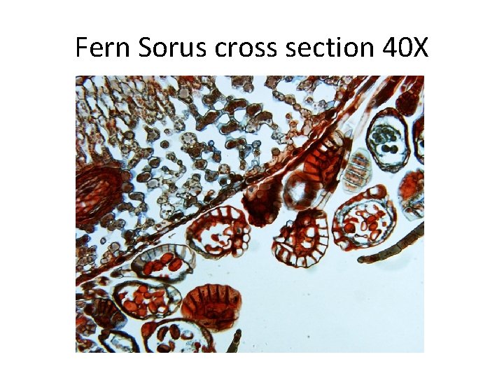 Fern Sorus cross section 40 X 