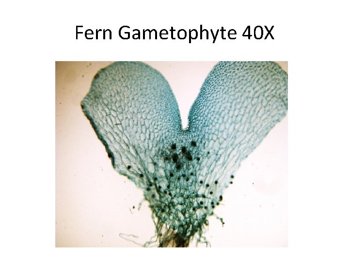 Fern Gametophyte 40 X 