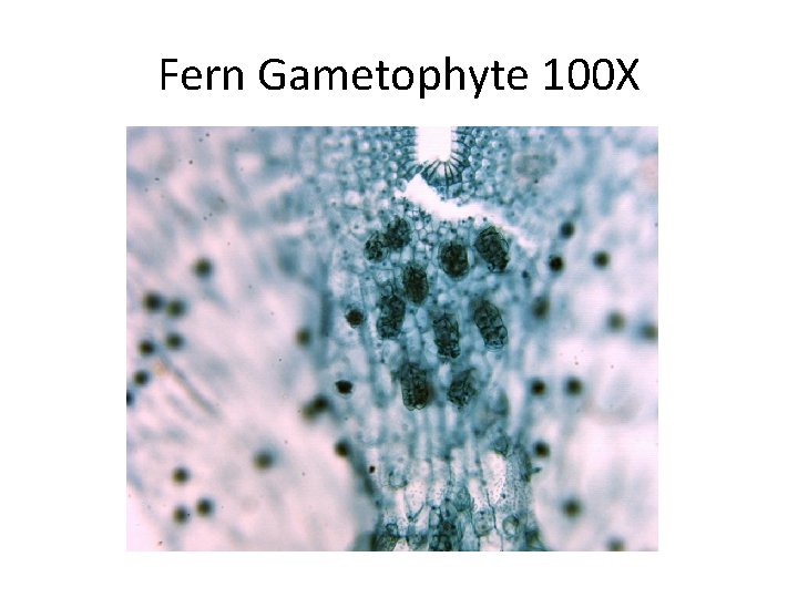 Fern Gametophyte 100 X 