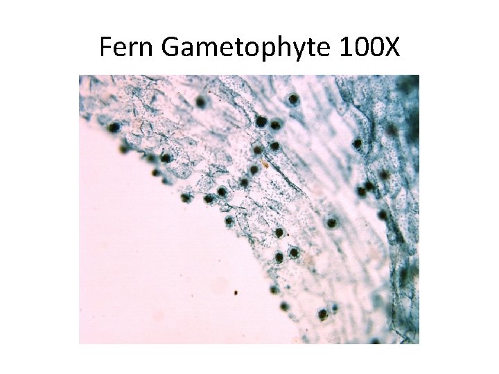 Fern Gametophyte 100 X 