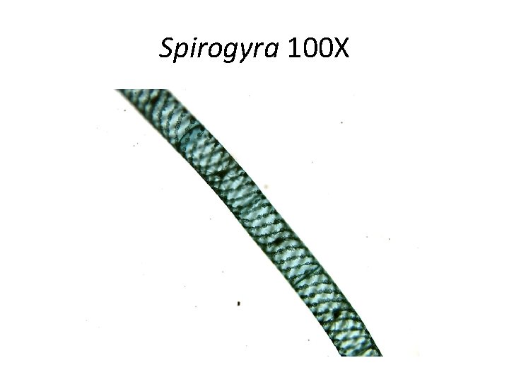 Spirogyra 100 X 