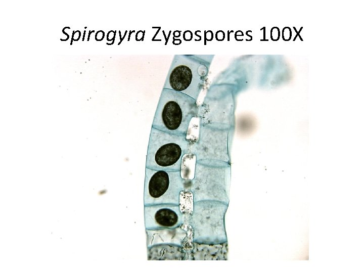 Spirogyra Zygospores 100 X 