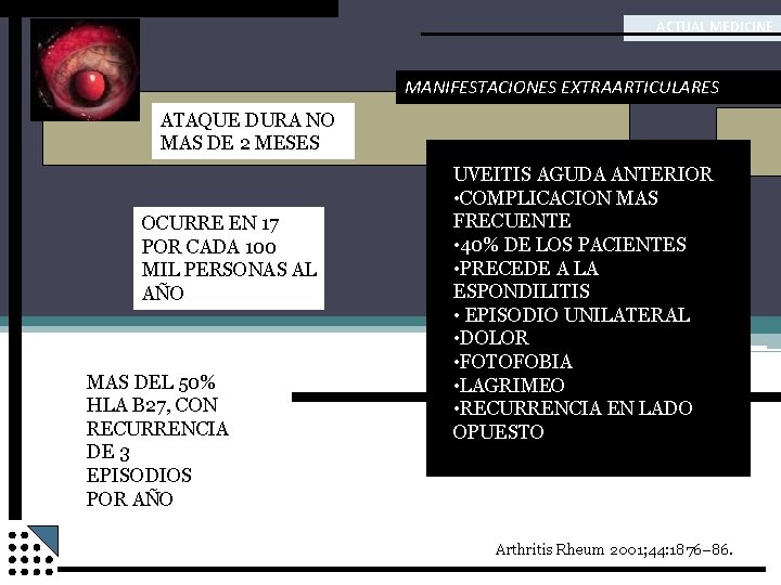 ACTUAL MEDICINE MANIFESTACIONES EXTRAARTICULARES ATAQUE DURA NO MAS DE 2 MESES OCURRE EN 17