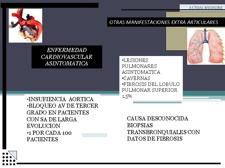 ACTUAL MEDICINE OTRAS MANIFESTACIONES EXTRA ARTICULARES ENFERMEDAD CARDIOVASCULAR ASINTOMATICA • INSUFIENCIA AORTICA • BLOQUEO