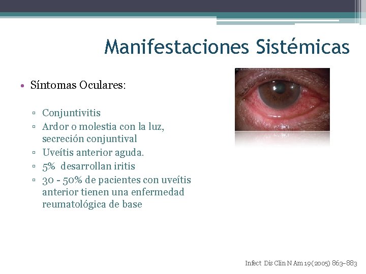Manifestaciones Sistémicas • Síntomas Oculares: ▫ Conjuntivitis ▫ Ardor o molestia con la luz,