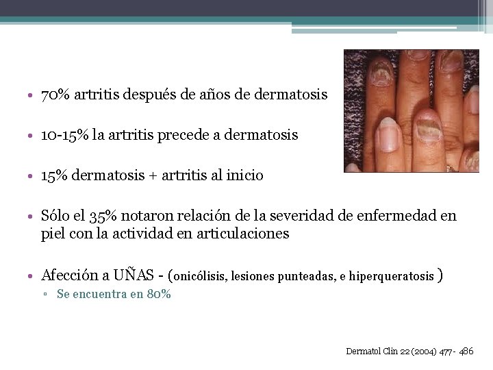  • 70% artritis después de años de dermatosis • 10 -15% la artritis