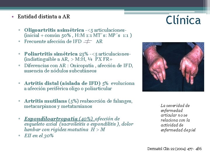  • Entidad distinta a AR Clínica ▫ Oligoartritis asimétrica -<5 articulaciones(inicial + común