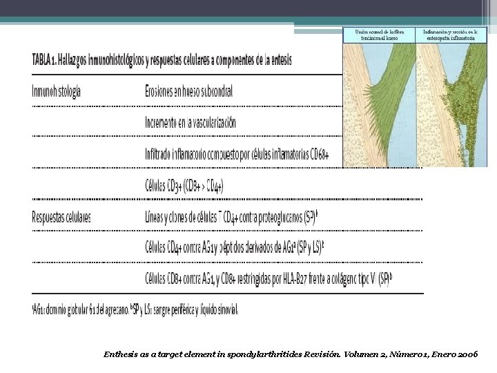 Enthesis as a target element in spondylarthritides Revisión. Volumen 2, Número 1, Enero 2006
