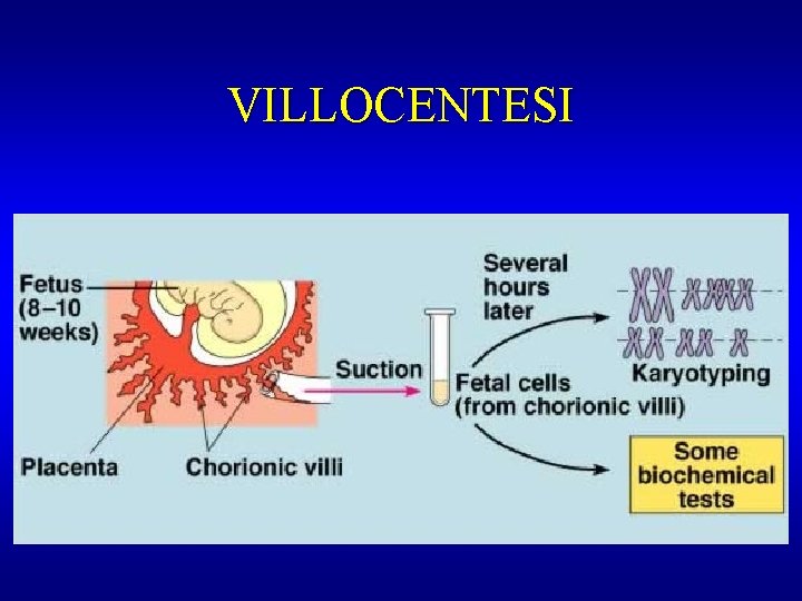 VILLOCENTESI 