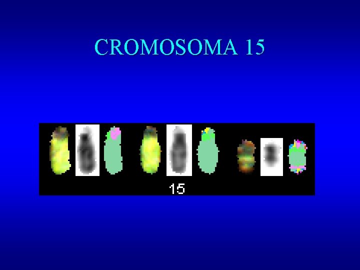 CROMOSOMA 15 