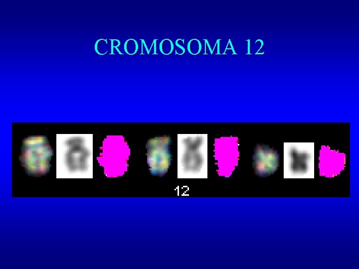 CROMOSOMA 12 