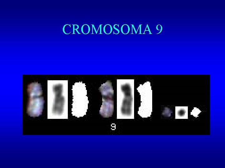 CROMOSOMA 9 