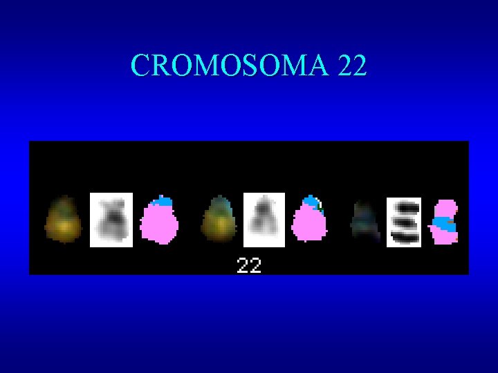 CROMOSOMA 22 