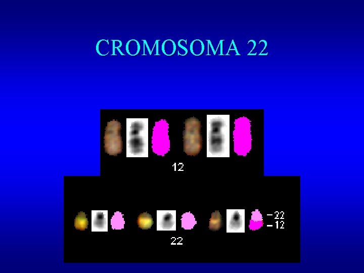 CROMOSOMA 22 