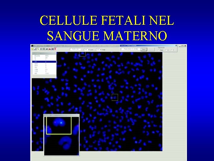 CELLULE FETALI NEL SANGUE MATERNO 