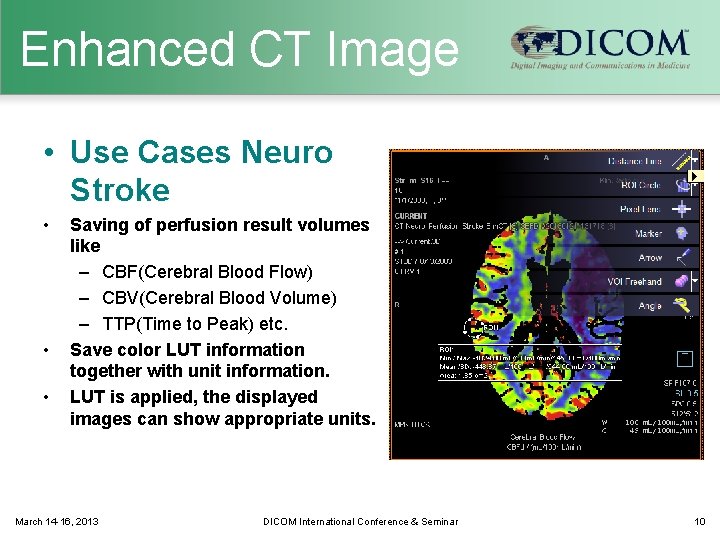 Enhanced CT Image • Use Cases Neuro Stroke • • • Saving of perfusion