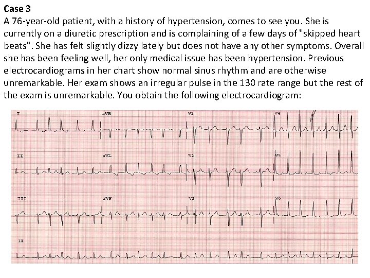 Case 3 A 76 -year-old patient, with a history of hypertension, comes to see