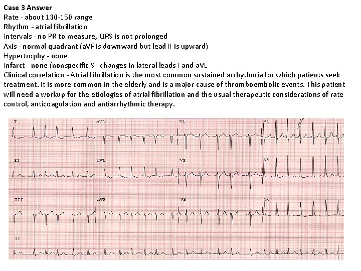 Case 3 Answer Rate - about 130 -150 range Rhythm - atrial fibrillation Intervals