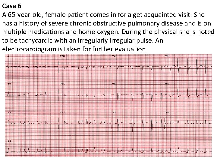 Case 6 A 65 -year-old, female patient comes in for a get acquainted visit.