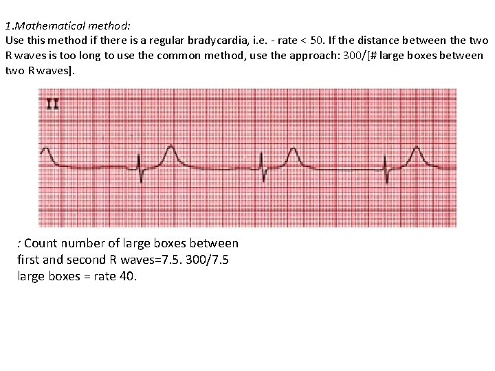 1. Mathematical method: Use this method if there is a regular bradycardia, i. e.