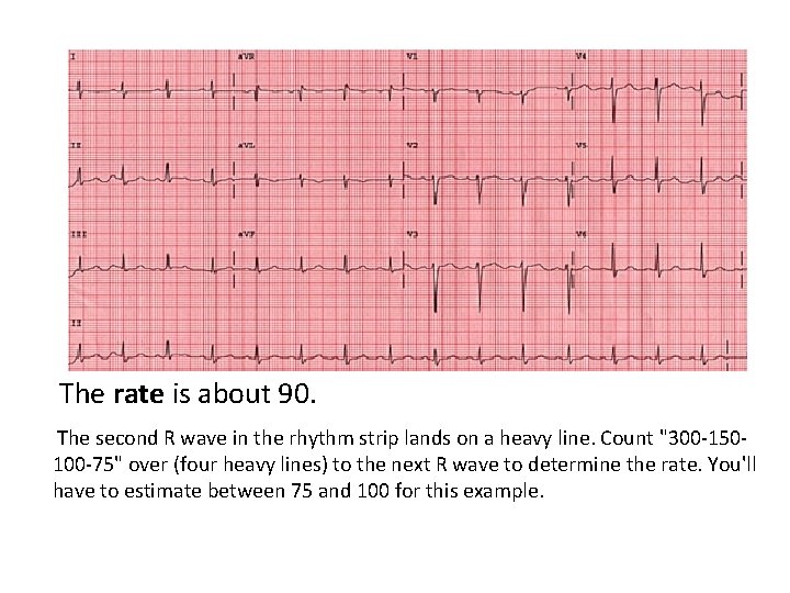 The rate is about 90. The second R wave in the rhythm strip lands