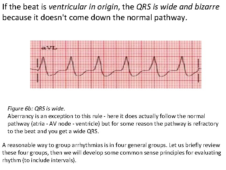 If the beat is ventricular in origin, the QRS is wide and bizarre because