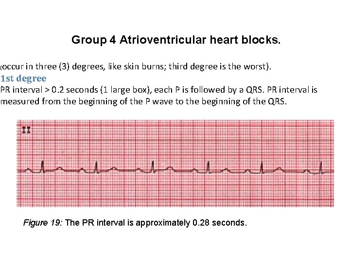 Group 4 Atrioventricular heart blocks. occur in three (3) degrees, like skin burns; third