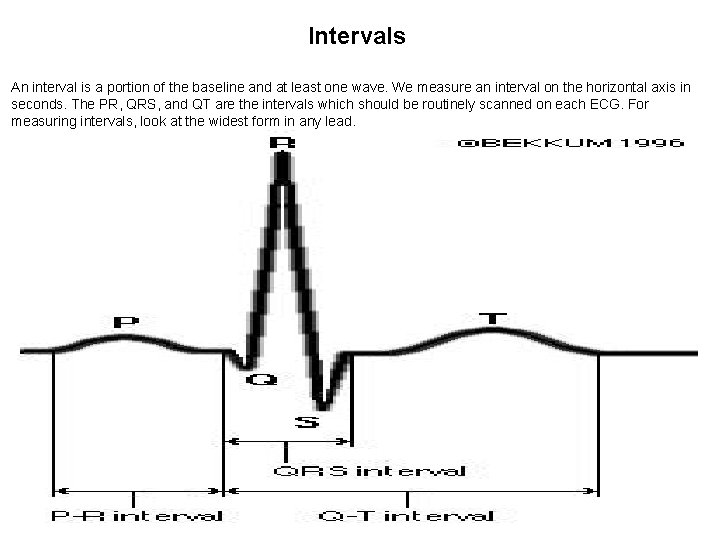 Intervals An interval is a portion of the baseline and at least one wave.