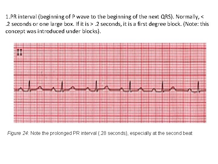 1. PR interval (beginning of P wave to the beginning of the next QRS).