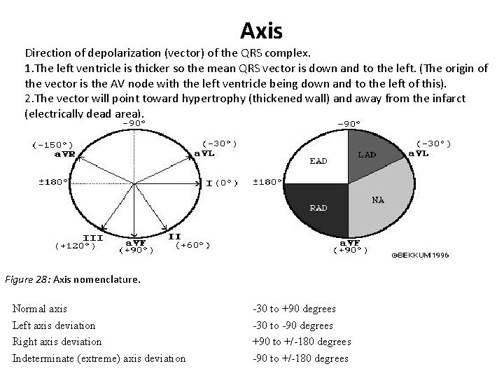 Axis Direction of depolarization (vector) of the QRS complex. 1. The left ventricle is