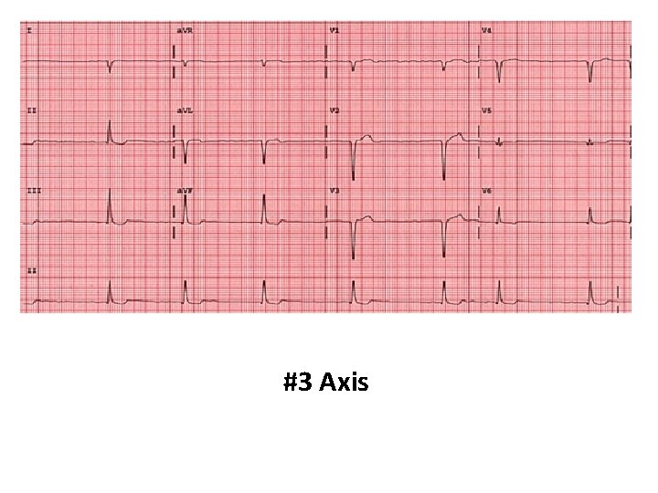 #3 Axis 