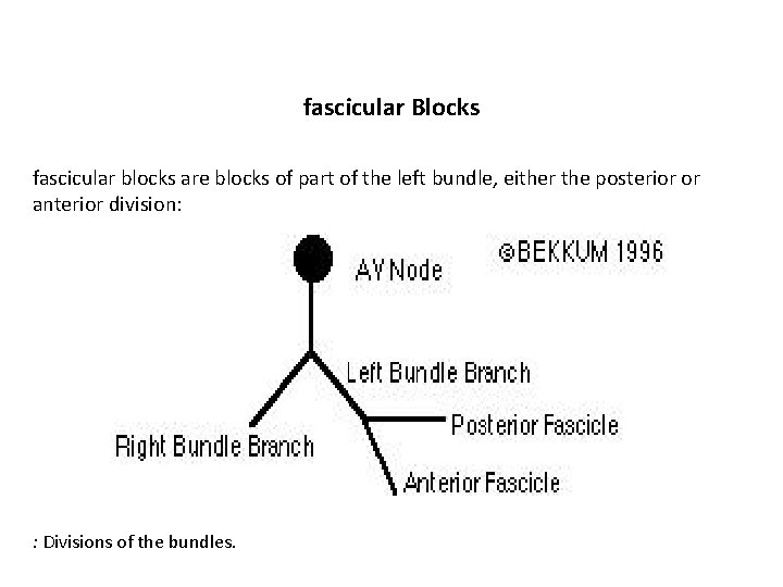 fascicular Blocks fascicular blocks are blocks of part of the left bundle, either the