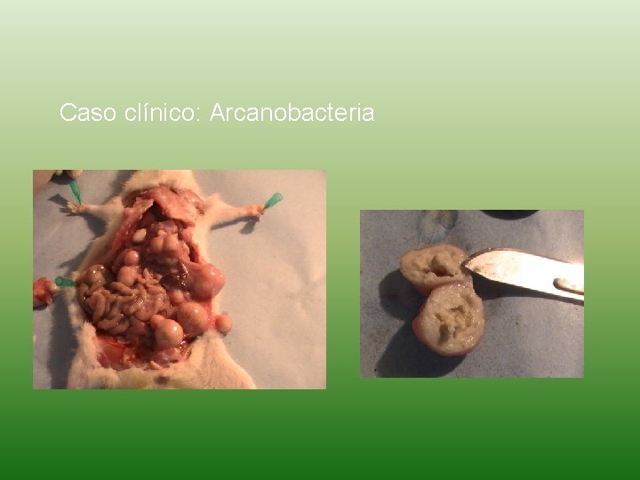Caso clínico: Arcanobacteria 