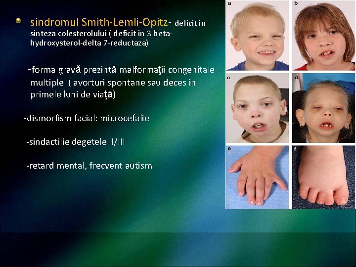 sindromul Smith-Lemli-Opitz- deficit in sinteza colesterolului ( deficit in 3 betahydroxysterol-delta 7 -reductaza) -forma